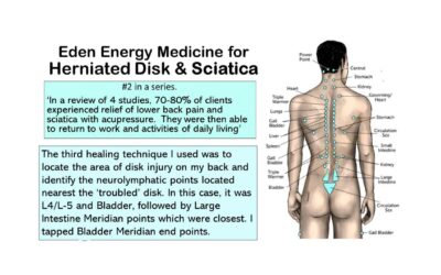 Herniated Disk & Sciatica – Part 2 of 5