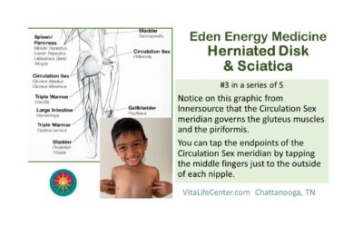 Herniated Disk & Sciatica – Part 3 of 5