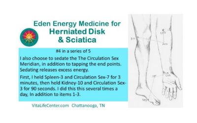 Herniated Disk & Sciatica – Part 4 of 5
