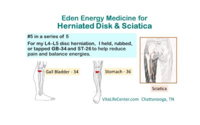 Herniated Disk & Sciatica – Part 5 of 5
